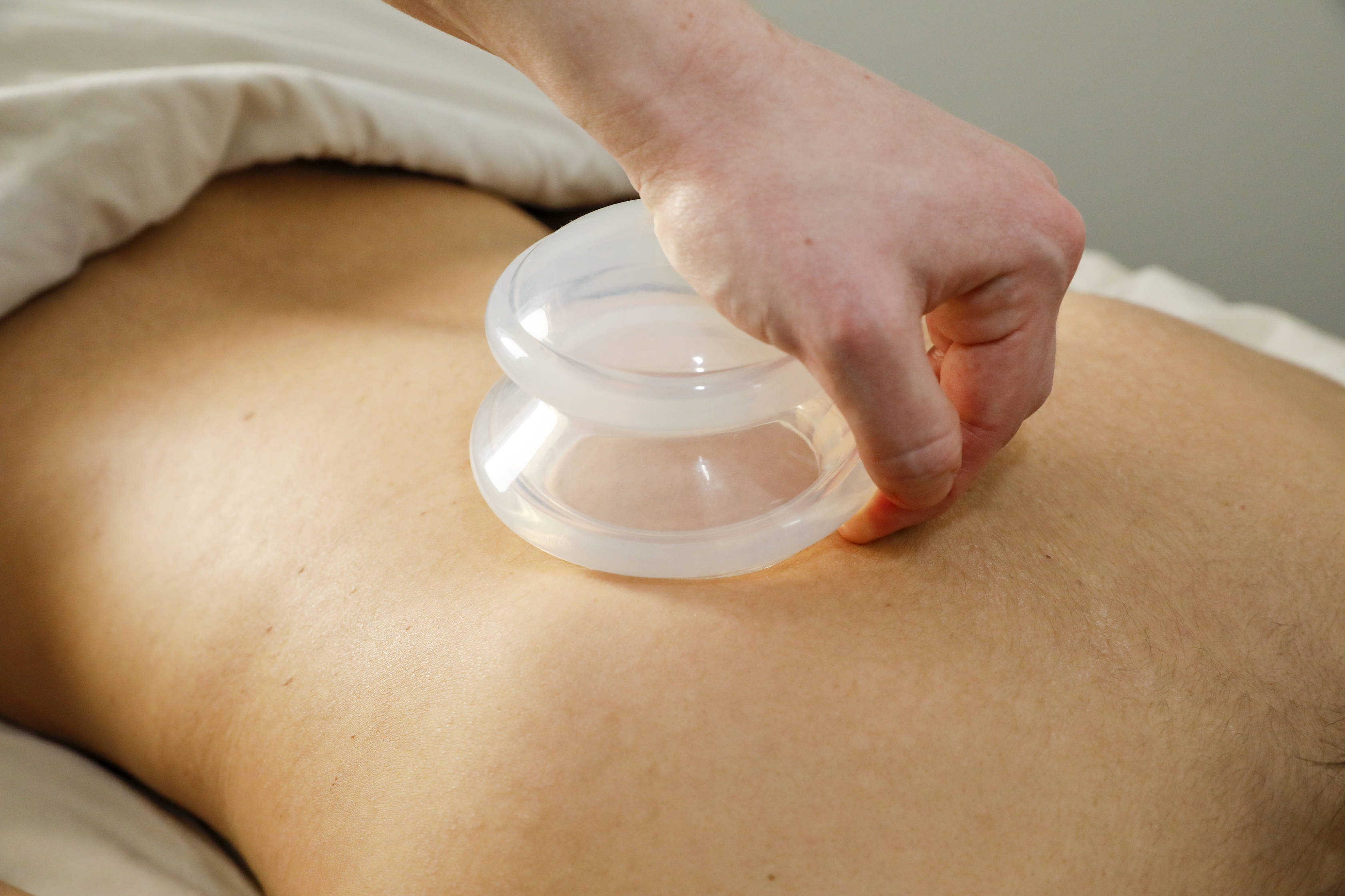 Cupping massage: What to expect • Resolution Health